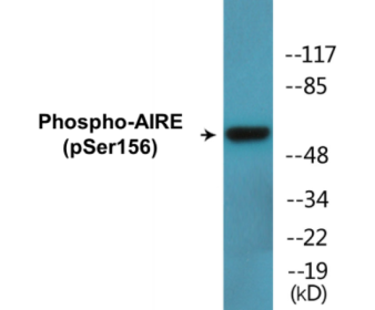 Phospho-AIRE (Ser156) Colorimetric Cell-Based ELISA Kit
