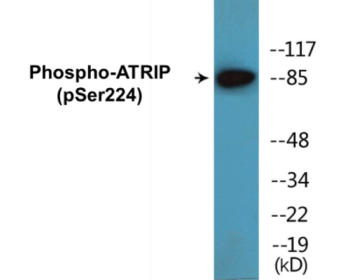Phospho-ATRIP (Ser224) Colorimetric Cell-Based ELISA Kit