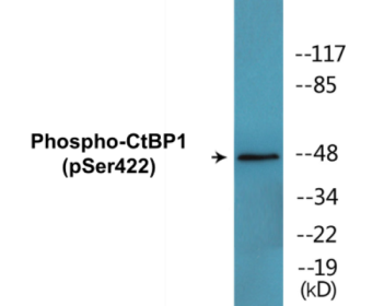 Phospho-CtBP1 (Ser422) Colorimetric Cell-Based ELISA Kit