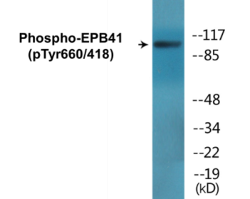Phospho-EPB41 (Tyr660/418) Colorimetric Cell-Based ELISA Kit
