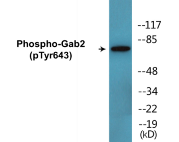Phospho-Gab2 (Tyr643) Colorimetric Cell-Based ELISA Kit