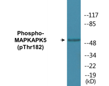 Phospho-MAPKAPK5 (Thr182) Colorimetric Cell-Based ELISA Kit