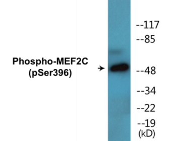 Phospho-MEF2C (Ser396) Colorimetric Cell-Based ELISA Kit