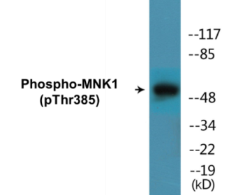 Phospho-MNK1 (Thr385) Colorimetric Cell-Based ELISA Kit