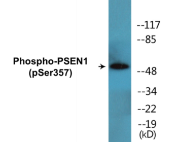 Phospho-PSEN1 (Ser357) Colorimetric Cell-Based ELISA Kit