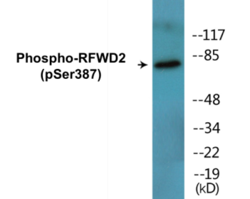 Phospho-RFWD2 (Ser387) Colorimetric Cell-Based ELISA Kit