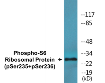 Phospho-RPS6 (Ser235+Ser236) Colorimetric Cell-Based ELISA Kit