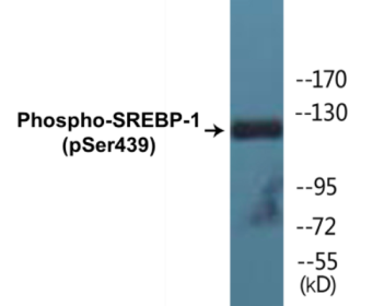 Phospho-SREBP-1 (Ser439) Colorimetric Cell-Based ELISA Kit