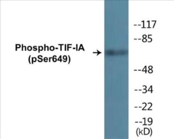Phospho-TIF-IA (Ser649) Colorimetric Cell-Based ELISA Kit
