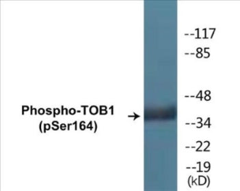 Phospho-TOB1 (Ser164) Colorimetric Cell-Based ELISA Kit