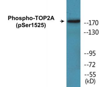 Phospho-TOP2A (Ser1525) Colorimetric Cell-Based ELISA Kit