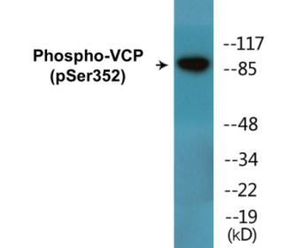 Phospho-VCP (Ser352) Colorimetric Cell-Based ELISA Kit
