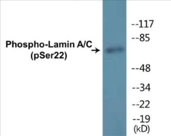 Phospho-Lamin A/C (Ser22) Colorimetric Cell-Based ELISA Kit