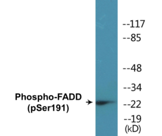 Phospho-FADD (Ser191) Colorimetric Cell-Based ELISA Kit
