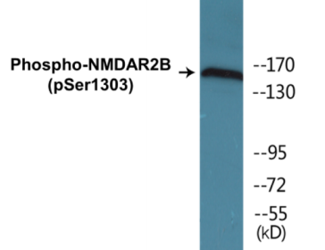 Phospho-NMDAR2B (Ser1303) Colorimetric Cell-Based ELISA Kit