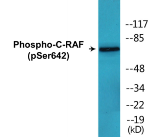 Phospho-C-RAF (Ser642) Colorimetric Cell-Based ELISA Kit