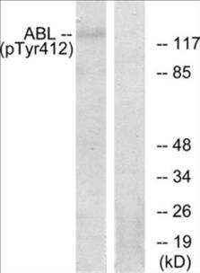Phospho-Abl (Tyr393/412) Colorimetric Cell-Based ELISA