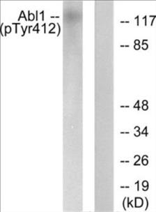 Phospho-Abl (Tyr412) Colorimetric Cell-Based ELISA