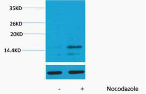 Histone H3 (Phospho-Ser28) Colorimetric Cell-Based ELISA Kit