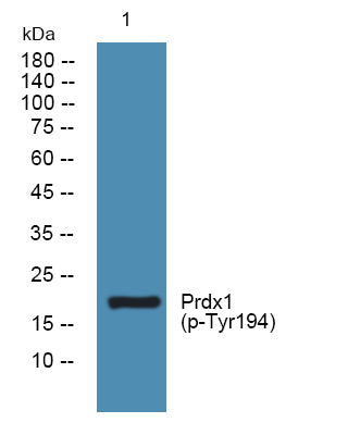 Prdx1 (Phospho-Tyr194) Colorimetric Cell-Based ELISA Kit