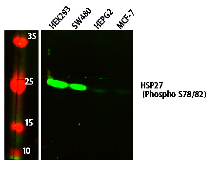 HSP27 (Phospho-S78/82) Colorimetric Cell-Based ELISA Kit