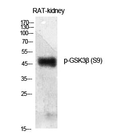 GSK3beta (Phospho-Ser9) Colorimetric Cell-Based ELISA Kit