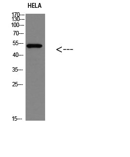 p53(Phospho-Ser366) Colorimetric Cell-Based ELISA Kit