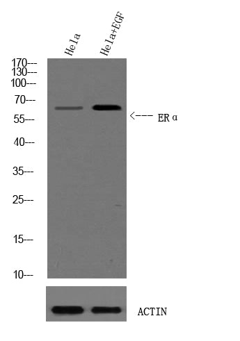 ERalpha (Phospho-Ser102) Colorimetric Cell-Based ELISA Kit