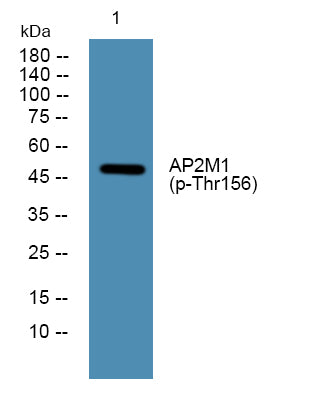 AP2M1 (Phospho-Thr156) Colorimetric Cell-Based ELISA Kit