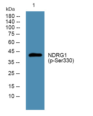 NDRG1 (Phospho-Ser330) Colorimetric Cell-Based ELISA Kit