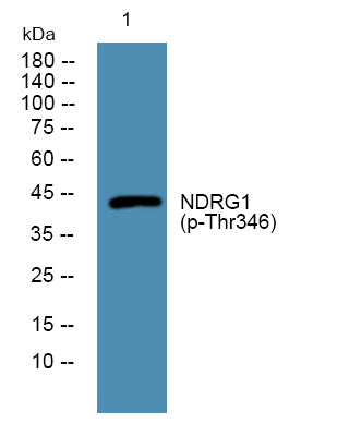 NDRG1 (Phospho-Thr346) Colorimetric Cell-Based ELISA Kit