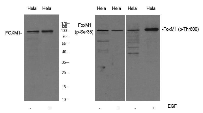 FoxM1 (Phospho-Thr600) Colorimetric Cell-Based ELISA Kit