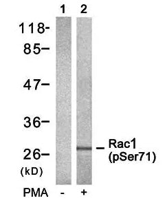 Rac1/cdc42 (Phospho-Ser71) Colorimetric Cell-Based ELISA Kit