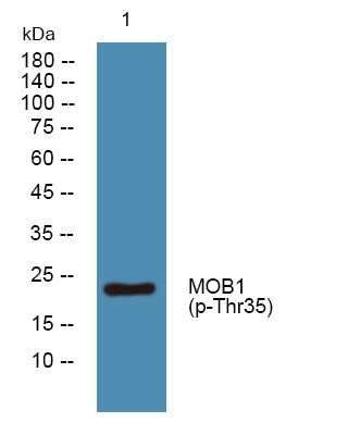 MOB1 (Phospho-Thr35) Colorimetric Cell-Based ELISA Kit