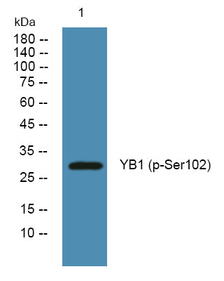 YB1 (Phospho-Ser102) Colorimetric Cell-Based ELISA Kit