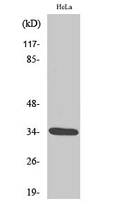 Cdk2 (Phospho-Thr160) Colorimetric Cell-Based ELISA Kit