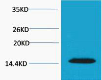 Histone H2A.X (Phospho-Thr120) Colorimetric Cell-Based ELISA Kit