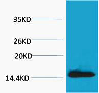 Histone H2A.X (Phospho-Tyr142) Colorimetric Cell-Based ELISA Kit