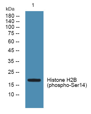 Histone H2B (Phospho-Ser14) Colorimetric Cell-Based ELISA Kit