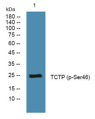 TCTP (Phospho-Ser46) Colorimetric Cell-Based ELISA Kit