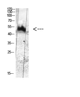 MDM2 (Phospho-Tyr394) Colorimetric Cell-Based ELISA Kit