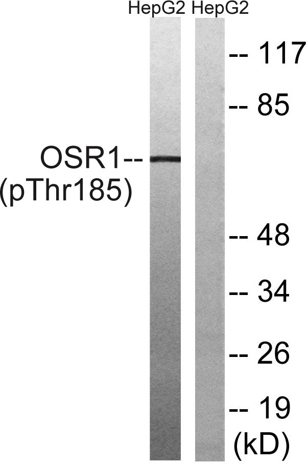 OSR1 (Phospho-Thr185) Colorimetric Cell-Based ELISA Kit