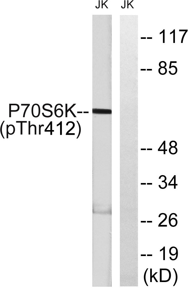 p70 S6 kinase alpha (Phospho-Thr412) Colorimetric Cell-Based ELISA Kit
