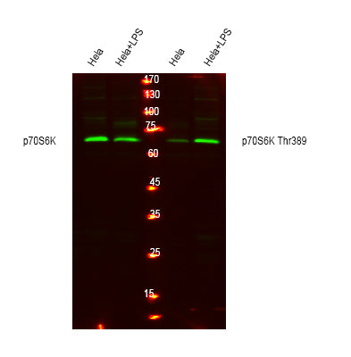 p70 S6 Kinase (Phospho-Thr389) Colorimetric Cell-Based ELISA Kit