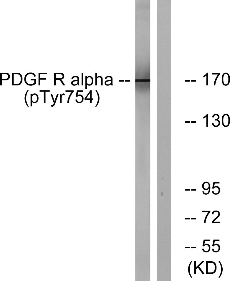 PDGFR-alpha (Phospho-Tyr754) Colorimetric Cell-Based ELISA Kit