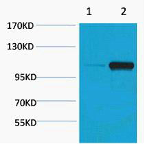 PEPC (Phospho-Ser15) Colorimetric Cell-Based ELISA Kit