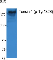 Tensin-1 (Phospho-Tyr1326) Colorimetric Cell-Based ELISA Kit