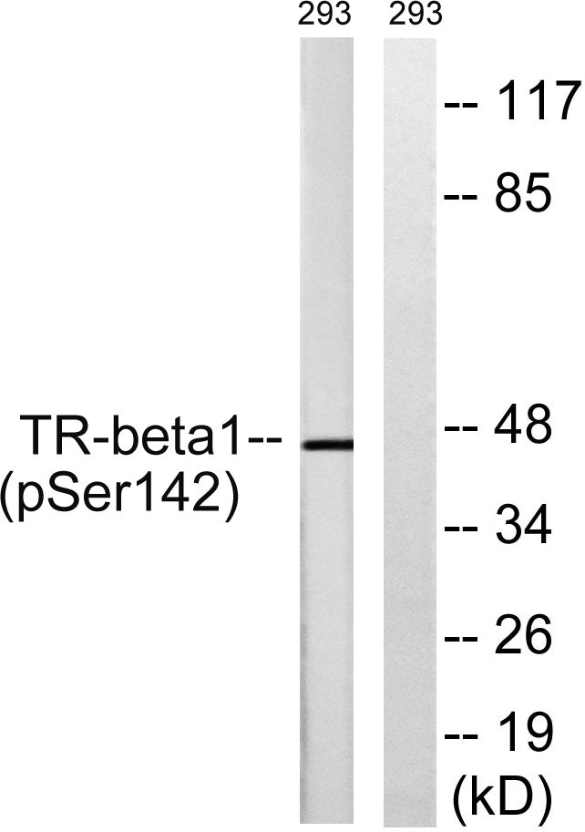 TRbeta1 (Phospho-Ser142) Colorimetric Cell-Based ELISA Kit