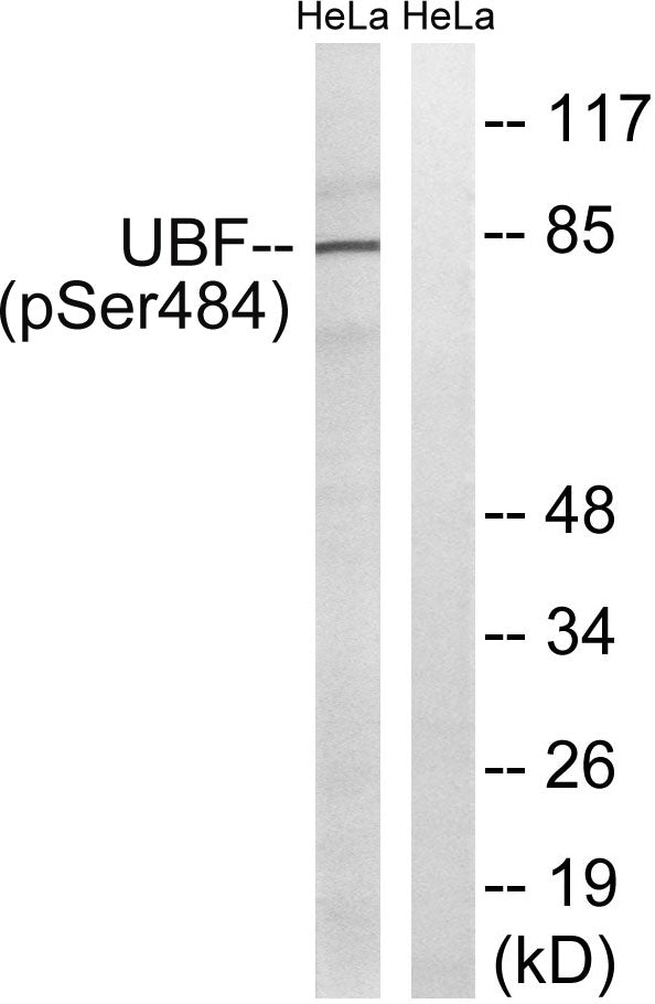UBF (Phospho-Ser484) Colorimetric Cell-Based ELISA Kit