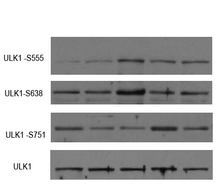 ULK1 (Phospho-Ser555) Colorimetric Cell-Based ELISA Kit